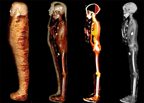 Radiologists Use CT Scans to ‘Digitally Unwrap’ Egypt’s Mummified ‘Golden Boy’